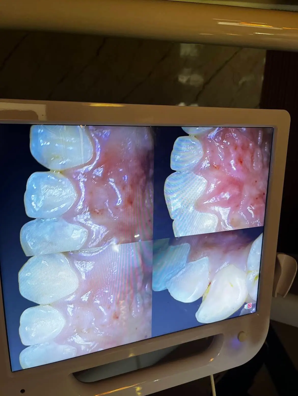 Imagens intraorais apresentadas no equipamento de diagnóstico da Dental Med